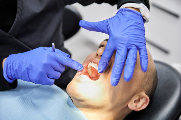 Best Emergency Tooth Extraction in Santa Anna, TX